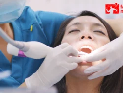 Scaling Gigi: Manfaat & Pentingnya Menjaga Kesehatan Mulut